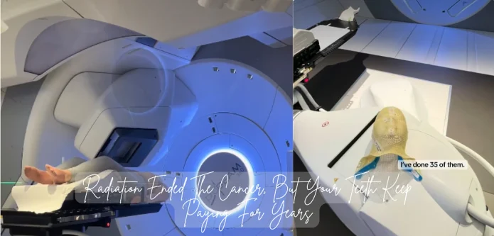 Teeth After Head And Neck Radiotherapy: What Nobody Warns