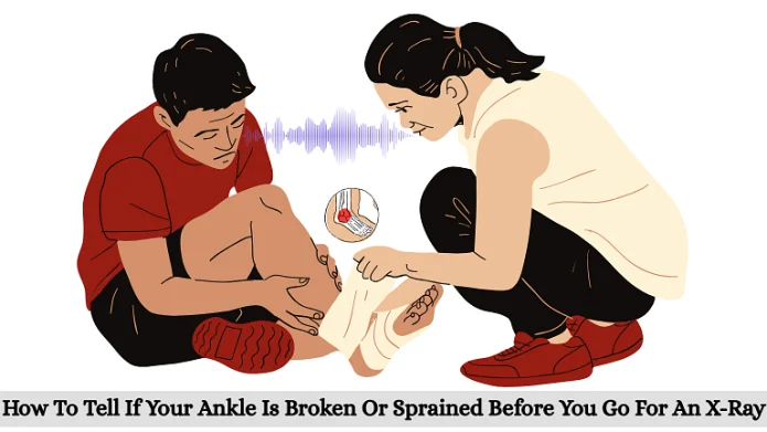 How To Tell If Your Ankle Is Broken Or Sprained Before An X-Ray